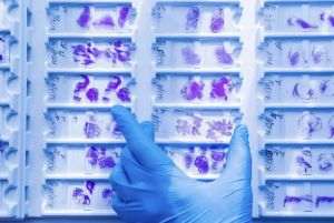 Sistemele de sănătate trebuie să treacă de la tratare la prevenţie, cu sprijinul tehnologiei